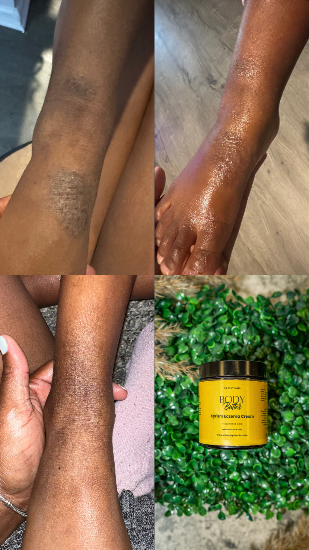 Kyrie’s Eczema Cream