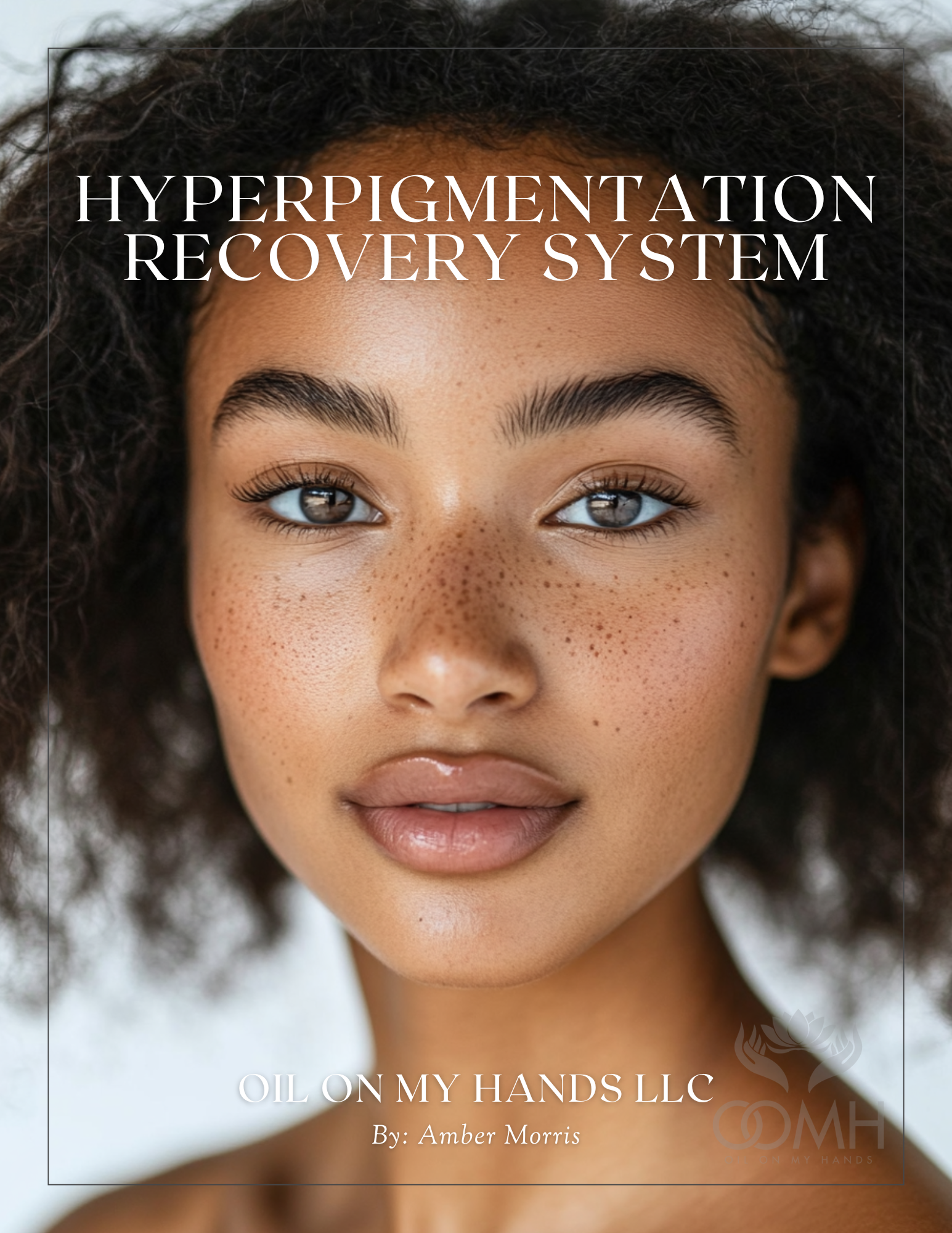 Hyperpigmentation Recovery System Guide Ebook
